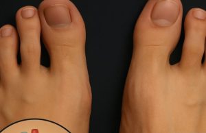 War:ning Signs of Heart Atta:cks in Women Over 40