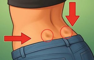 Why Do Only Some People Have These Back Dimples?