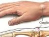Lumps on the hands: here’s what you should know about them