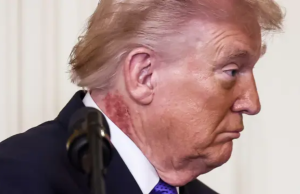 Donald Trump sparks fresh health concerns with scabbing neck rash